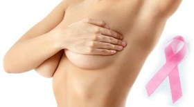 Οι παχύσαρκες γυναίκες  μετά την εμμηνόπαυση μπορεί να αντιμετωπίσουν υψηλότερο κίνδυνο εμφάνισης καρκίνου του μαστού.